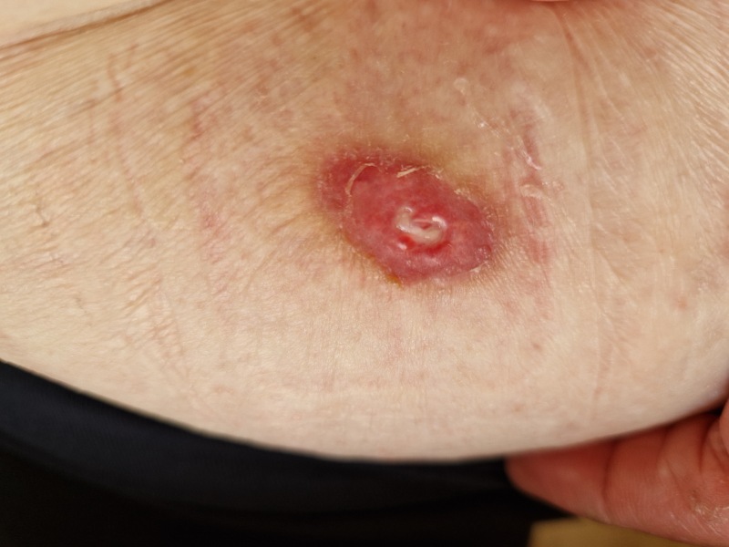 Random raw skin thing - ideas?