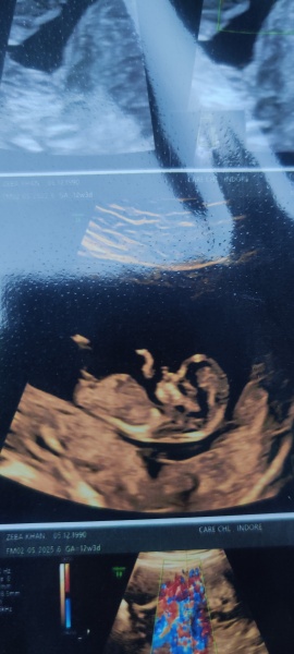 Identify nub theory boy or girl