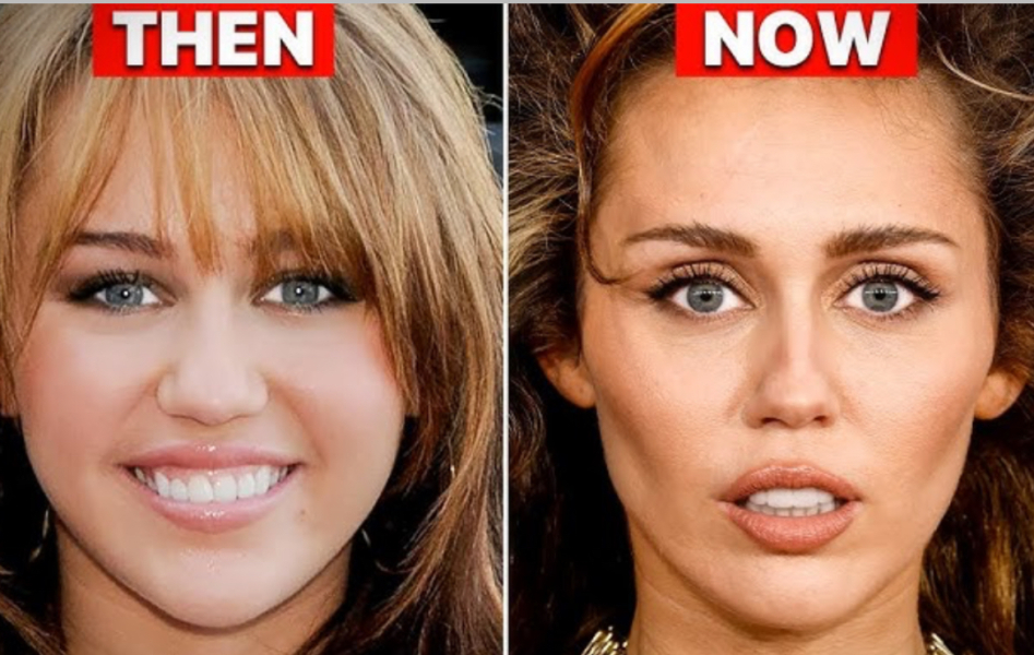 To find beauty treatments a bit cringe now