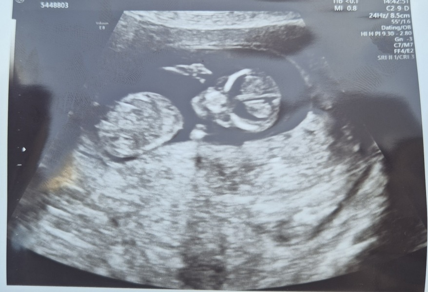 November 2025 #Thread 2 🤰🏻