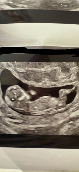 12 weeks and 6 days