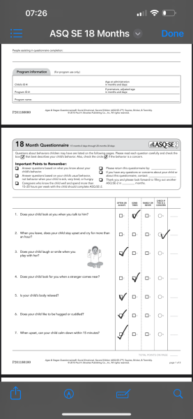 18 month old development delay?