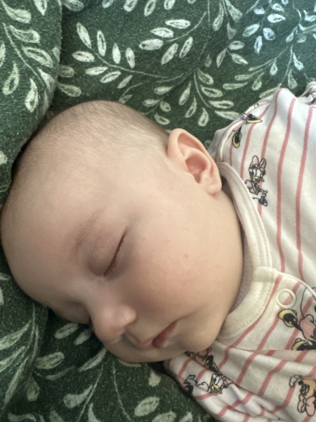 3 month old bad skin