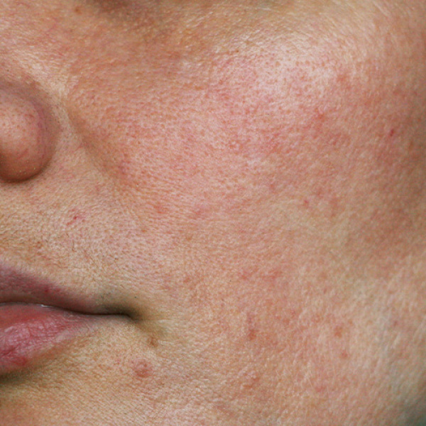 What kind of skincare product or lifestyle change will fix this issue?