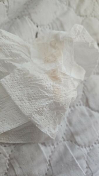 Could this be implantation bleed