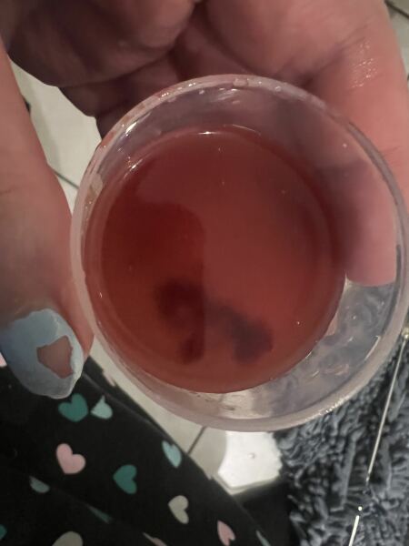 Haven’t had a period since I was 13 but bleeding and clots?
