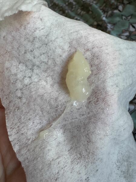 Is this discharge normal postpartum??? PHOTO TMI