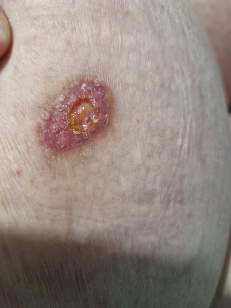 Random raw skin thing - ideas?