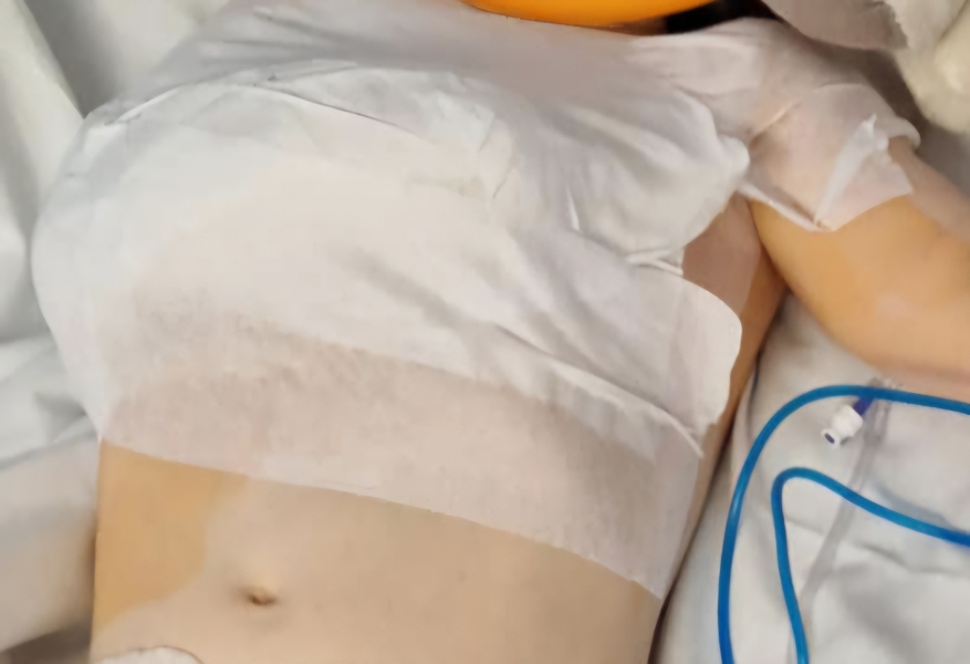 What to do with preschooler with one usable arm