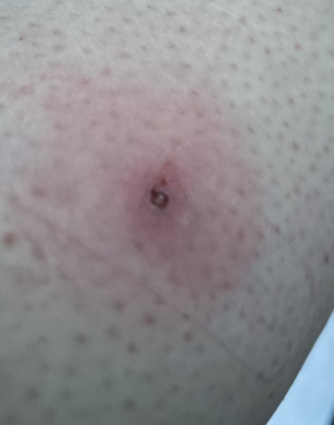 To be worried about this on my leg?