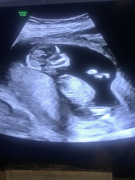 Skull Theory - Gender Prediction - Bit of fun!