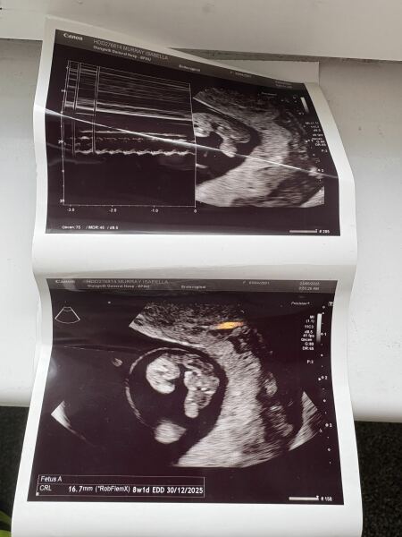 Due January 2026 ✨