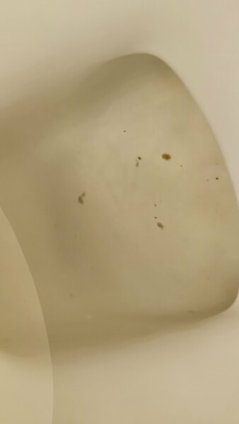 Weird bits in toddlers urine