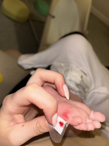 Has anyone else’s baby been injured by the Snuggle Baby Bath?