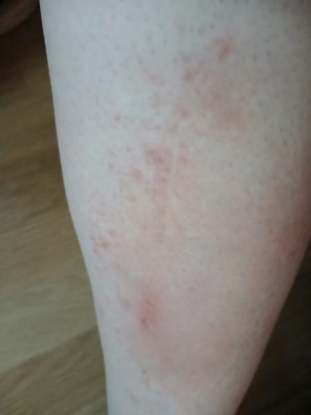 What is wrong with my leg? Pic attached!