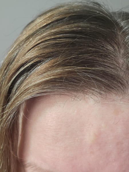 What's this on my forehead