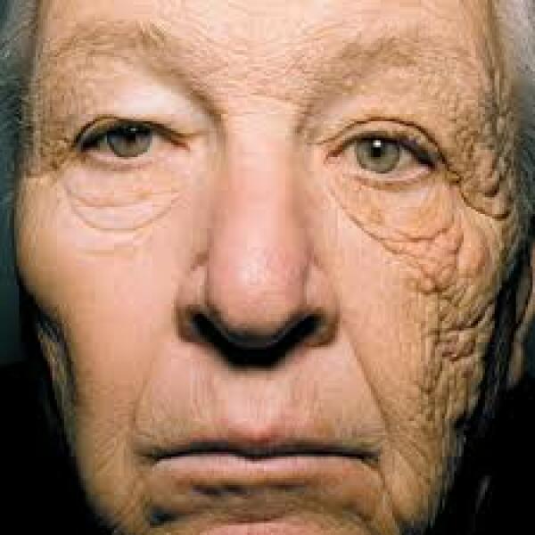 Using Sunbeds to prevent sunburn