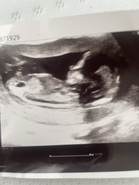 Any guesses boy or girl?
