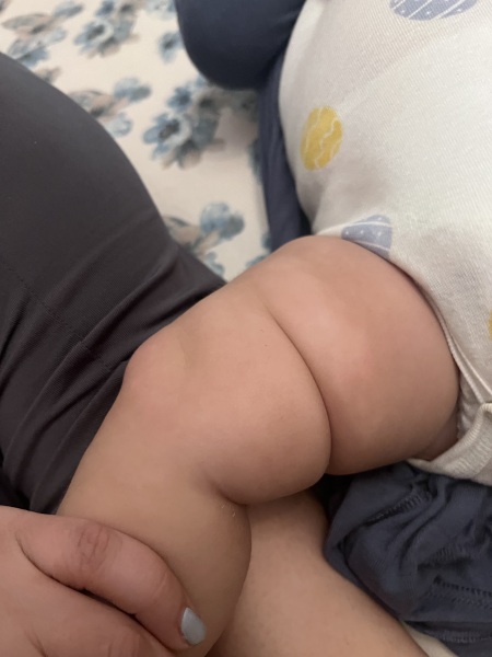 What’s this on my babies leg?