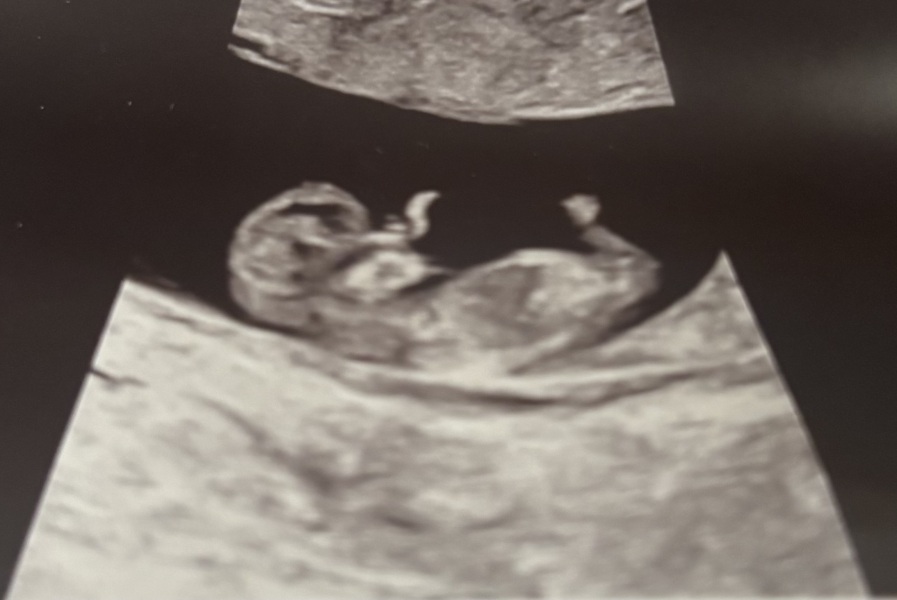 Can anyone help me it’s boy or girl 12 week scan