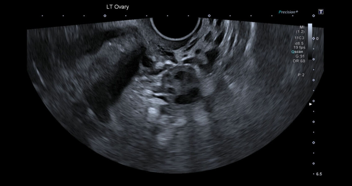 Ovary scan image - what am I looking at?