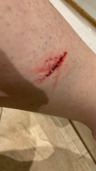 March 2025 starters Thread 5