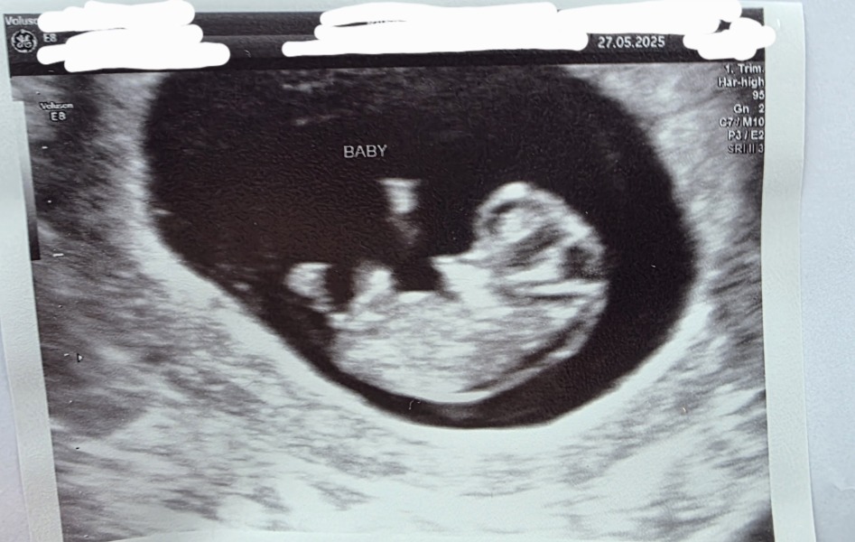 Due December 2025