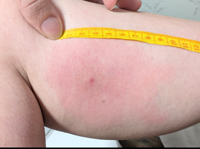 To be worried about this on my leg?