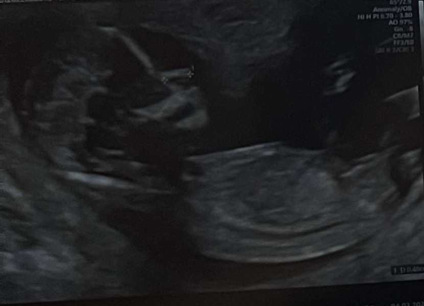 Gender Guess