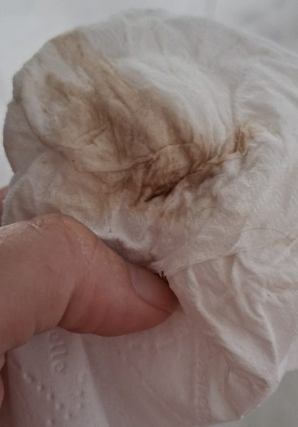 Trigger warning-anyone know what spottimg below is?