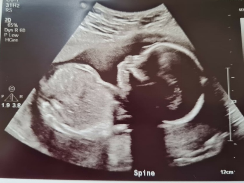 Scan photo