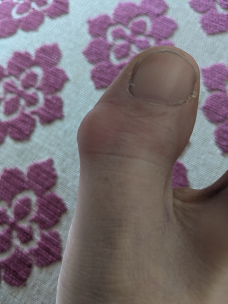 What is this? It bloody hurts