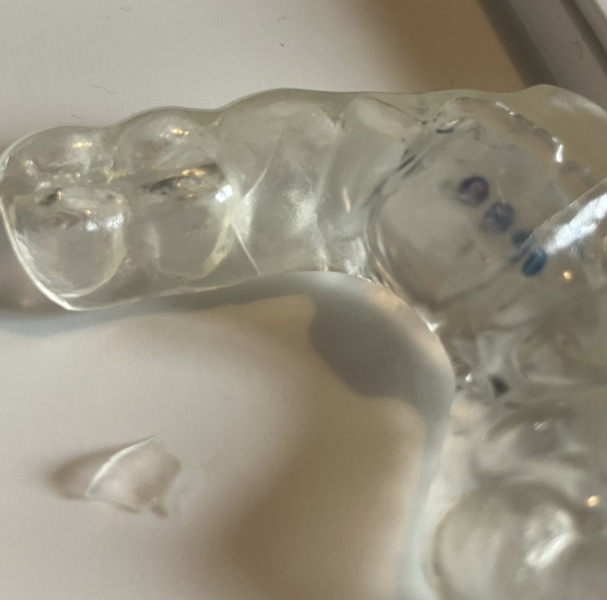 Angry, shattered brand new £500 dental splint