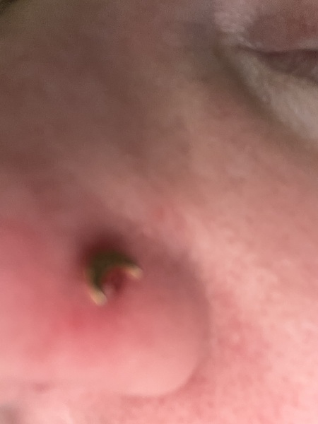 How to remove a nostril piercing