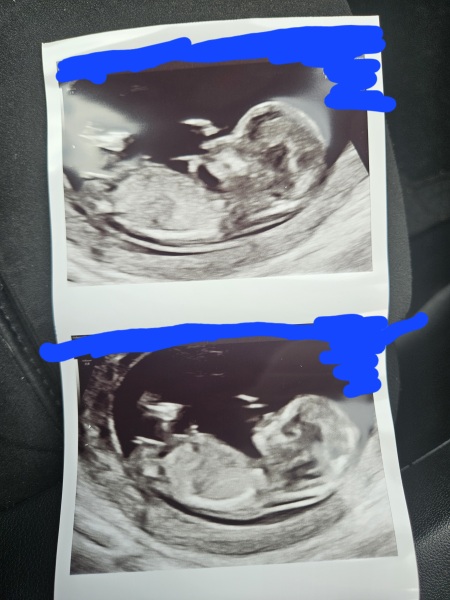 Boy or girl