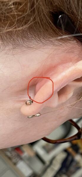 Am I paranoid or should I get this checked out?