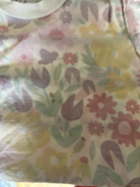 What are these stains?