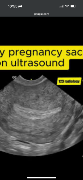 Got this after ovulated
