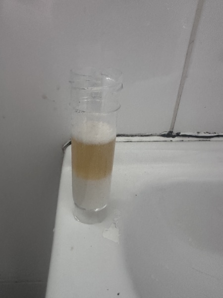 Baking soda test