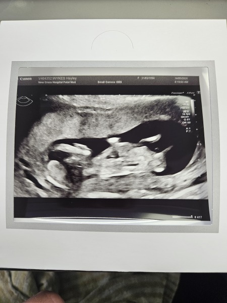 What do we think? Boy or girl?