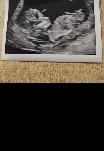 Boy or girl