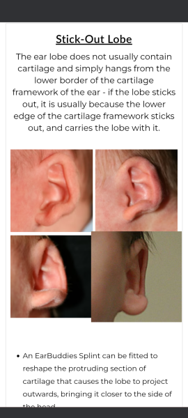DS (6) earlobes stick outwards