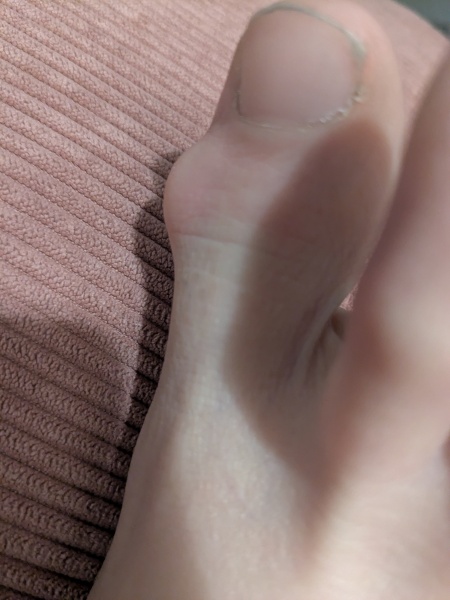 What is this? It bloody hurts