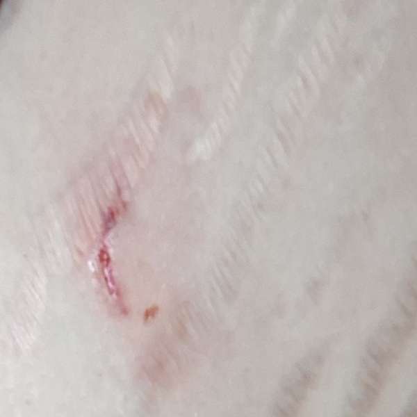Aggressive dog or my fault
