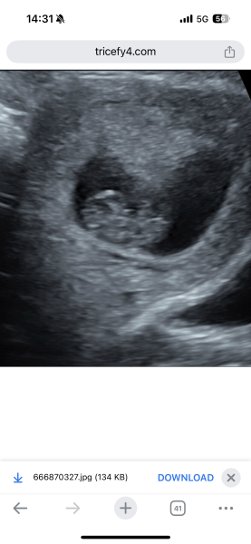 Due December 2025