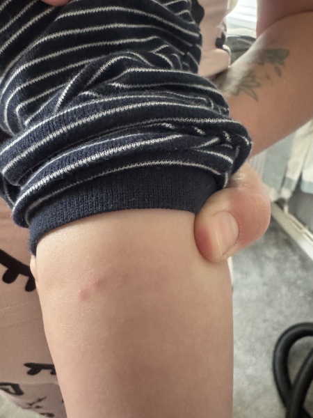To take him to hospital?