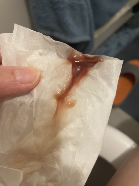 Is this my mucus plug?