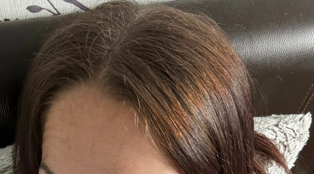 To continue to grow out hair colour or strip