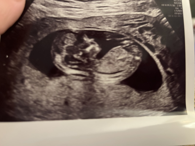 Just a bit of fun - gender predictions!