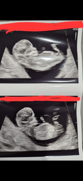 12 Week Nub Theory Guesses